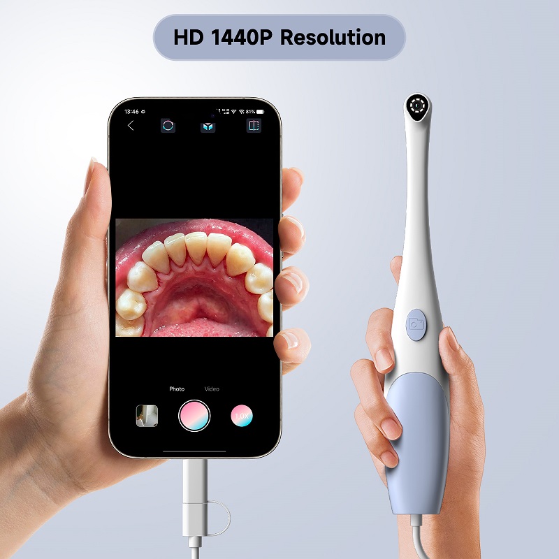 口腔内視鏡カメラ 1440P 写真&ビデオハンドヘルドビジュ - Macro Photography Led Lighting のレビューと価格